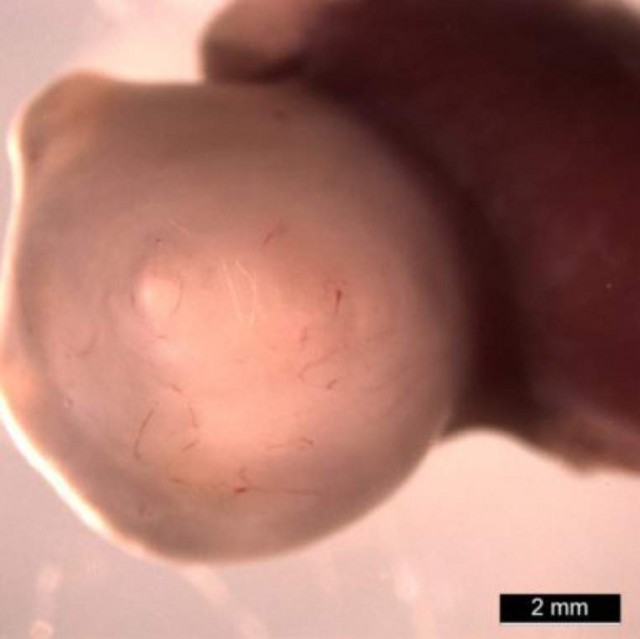 Органоїд шлунка 10-тижневого віку, який росте всередині миші /Фото Медичний центр дитячої лікарні Цинциннаті   